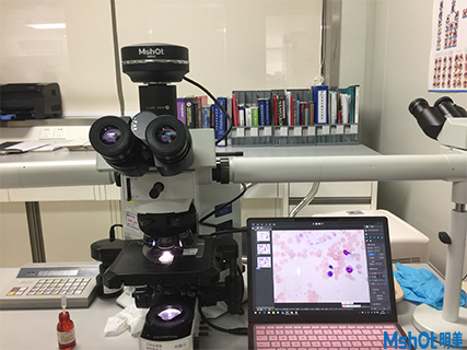 明美科研級(jí)攝像頭助力香港大學(xué)深圳醫(yī)院血液科骨髓切片觀察