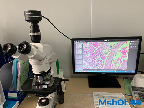 明美高分辨率顯微鏡相機(jī)助力病理切片檢驗(yàn)