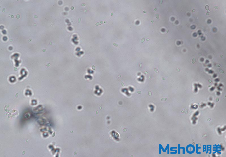 國產(chǎn)生物顯微鏡搭配顯微鏡相機(jī)觀察到乳酸菌