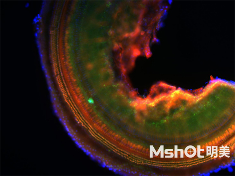 倒置熒光顯微鏡應(yīng)用于小鼠耳蝸觀察