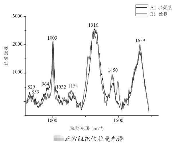 便攜式光纖拉曼胃癌檢測儀的研發(fā)和應(yīng)用